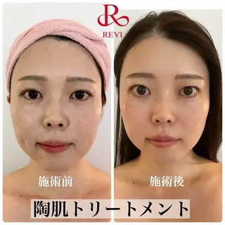 Butterfly 平塚店　佐藤のエステ・リラクイメージ