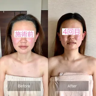 小顔&ヘッドスパ haruhandのエステ・リラクイメージ