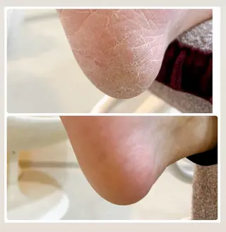 ネイル SWEET NAIL所属・SWEET NAILのネイルデザイン