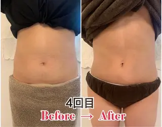 Beauty Salon Mirei所属・ﾋﾞｭｰﾃｨｰｻﾛﾝ Mirei 山下の眉毛・アイブロウイメージ