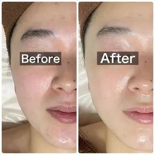 beauty salon  SUKOBI所属・ﾋﾞｭｰﾃｨｻﾛﾝ SUKOBIのエステ・リラクイメージ