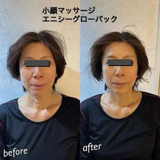 うなじ脱毛/美肌脱毛 LABELのエステ・リラクイメージ