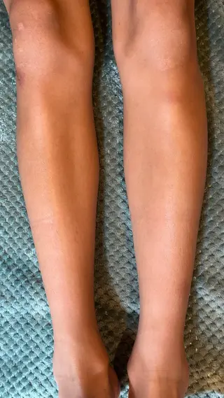 yellow.所属・yellow💛【 脱毛&フェイシャル】のエステ・リラクイメージ