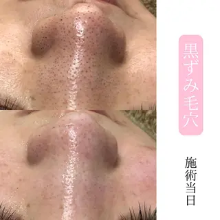 肌質改善サロン BestBelleのエステ・リラクイメージ