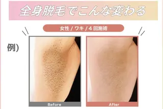 美肌脱毛サロン muroのエステ・リラクイメージ