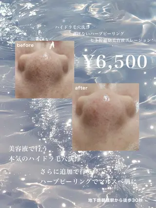 Kanunu所属・鶴橋エステ kanunuのエステ・リラクイメージ