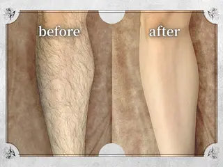 都度払い脱毛 Lino柏/Moneのエステ・リラクイメージ