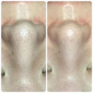 Biestora 郡山店/橋本のエステ・リラクイメージ