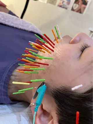 美容鍼灸女性専用 りんご鍼灸治療院のその他イメージ