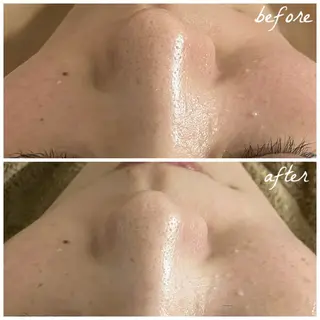 メンズ メナード岐阜市茜部 杉浦のエステ・リラクイメージ