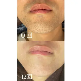 メンズ 津田沼店 Earthのエステ・リラクイメージ