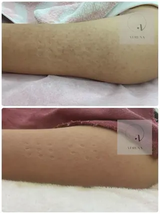 ニキビ改善専門店 d'Albaのエステ・リラクイメージ