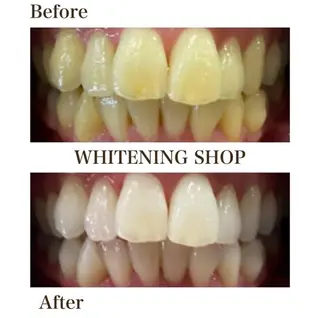 ホワイトニングショップ津店所属・ホワイトニング ショップ津店のその他イメージ