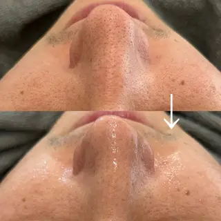 カンナムビューティー麻布十番店所属・bizz bizz 麻布十番🌿のその他イメージ