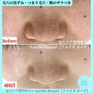 毛穴ケア専門サロン Amélio Beauté所属・毛穴ケア専門サロン アメリオボーテのその他イメージ