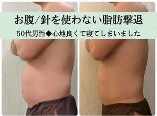 痩身/デトックス しほのエステ・リラクイメージ