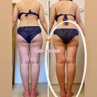 ショート カラー パーマ ヘアアレンジ メンズ キッズ ネイル マツエク・マツパ アイブロウ ‍痩身＆ボディ 結果出し🌟丹野のエステ・リラクイメージ