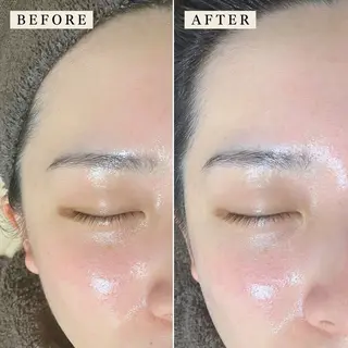 【産毛・眉毛ケア＆肌質改善サロン】＊BiBi＊beautysalon所属・眉･産毛専門BiBi 糸脱毛スレッティングのエステ・リラクイメージ