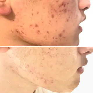 アイブロウ Epina 千葉店 【エピナ】のエステ・リラクイメージ