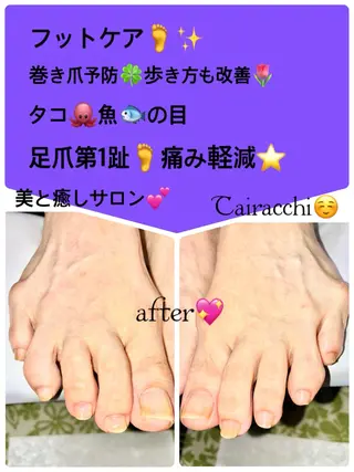 ネイル Tairacchi ﾀｲﾗｯﾁのエステ・リラクイメージ