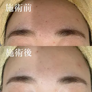 U24限定クーポン レイビス池袋MANAのエステ・リラクイメージ