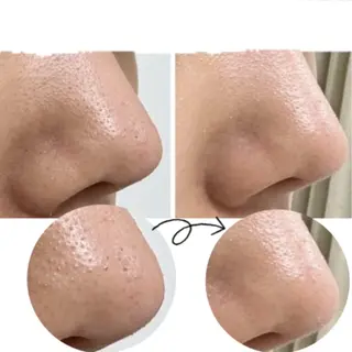 Total beauty salon Remy所属・Remy♡ 石井澪菜のエステ・リラクイメージ