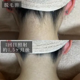 脱毛専門サロン BELFINE恵比寿のエステ・リラクイメージ