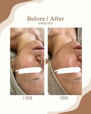 1st｜フェイシャル エステ専門店のエステ・リラクイメージ