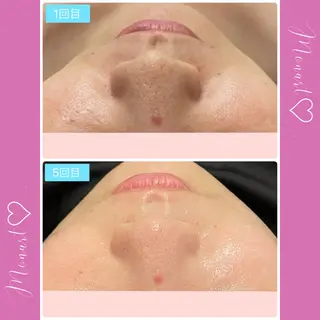 Monart -deux-のエステ・リラクイメージ