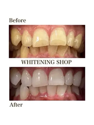 ホワイトニングショップ津店所属・ホワイトニング ショップ津店のその他イメージ