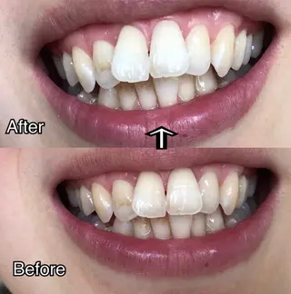 西宮ホワイトニング Kirarie所属・志水 有美のエステ・リラクイメージ