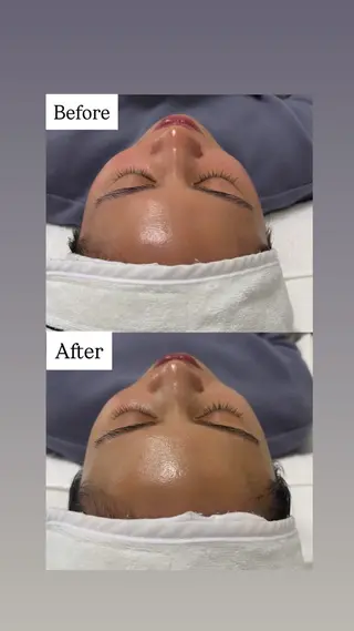 Hilluin所属・Hilluin大曽根 韓国肌管理のエステ・リラクイメージ