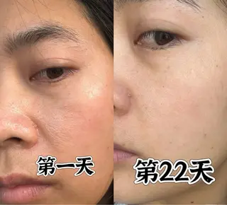 カラー aliaハイフ&水光ジェットサロン所属・aliaハーブ水光店 エステティシャン募集のエステ・リラクイメージ