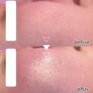 韓国肌管理専門店　White labo 新潟店所属・韓国肌管理専門店 Rihoのエステ・リラクイメージ