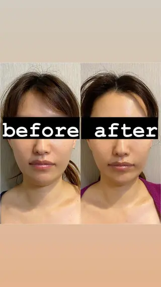 美容鍼灸サロンRemeリミー所属・美容鍼WINBACK サロンRemeのエステ・リラクイメージ