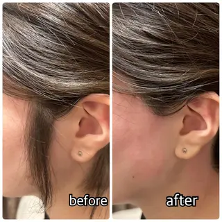 【横浜】アイリス エステティックのエステ・リラクイメージ