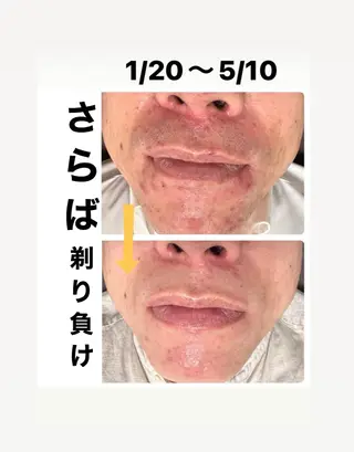 メンズ メンズ脱毛サロン Le falcoのエステ・リラクイメージ