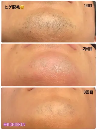 【痩身・脱毛サロン】 REBISKIN🌱のエステ・リラクイメージ