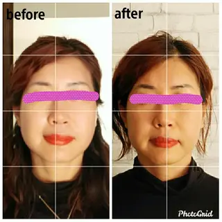 美容矯正 ＱＵＩＣＯ【キコ】のその他イメージ