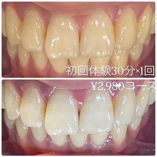 PLATINUM Beauty 横浜店所属・ホワイトニングルーム 横浜店のその他イメージ