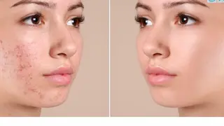 ナウフィールド 今野のエステ・リラクイメージ