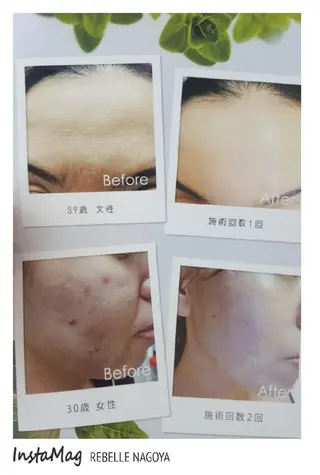 パーマ ヘアアレンジ キッズ メンズ マツエク・マツパ カラー ミディアム 次世代まつげパーマは 『リベル名古屋』のマツエク・マツパデザイン