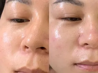 愛維美水光美肌専門店所属・愛維美水光美肌専門店 メンズレディースokのエステ・リラクイメージ