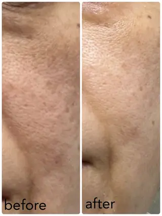 HISUI所属・IVY化粧品・ 勝山亜優奈のエステ・リラクイメージ