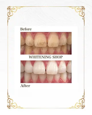 ホワイトニングショップ静岡葵区店所属・ホワイトニング ショップ葵区静岡駅店のその他イメージ