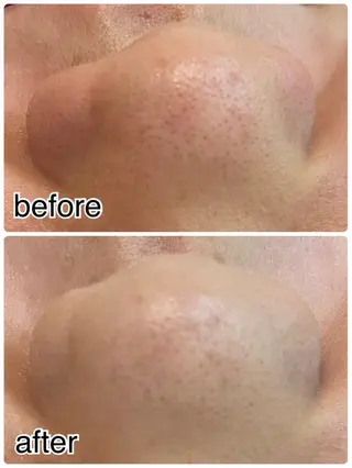 韓国最先端技術サロン Luangeのヘアスタイル