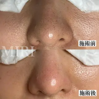 MIRI所属・北堀江/毛穴改善専門 ミリのエステ・リラクイメージ