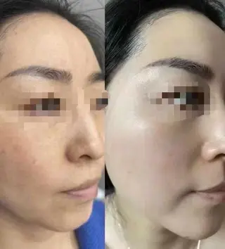 ネイル aliaハイフ&水光ジェットサロン所属・aliaハーブ水光店 エステティシャン募集のエステ・リラクイメージ