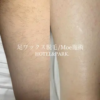 HOTEL&PARK .Moeワックス脱毛のエステ・リラクイメージ