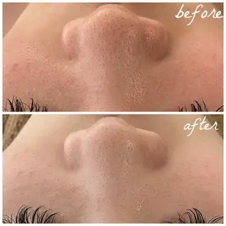 メンズ メナード岐阜茜部 杉浦のエステ・リラクイメージ